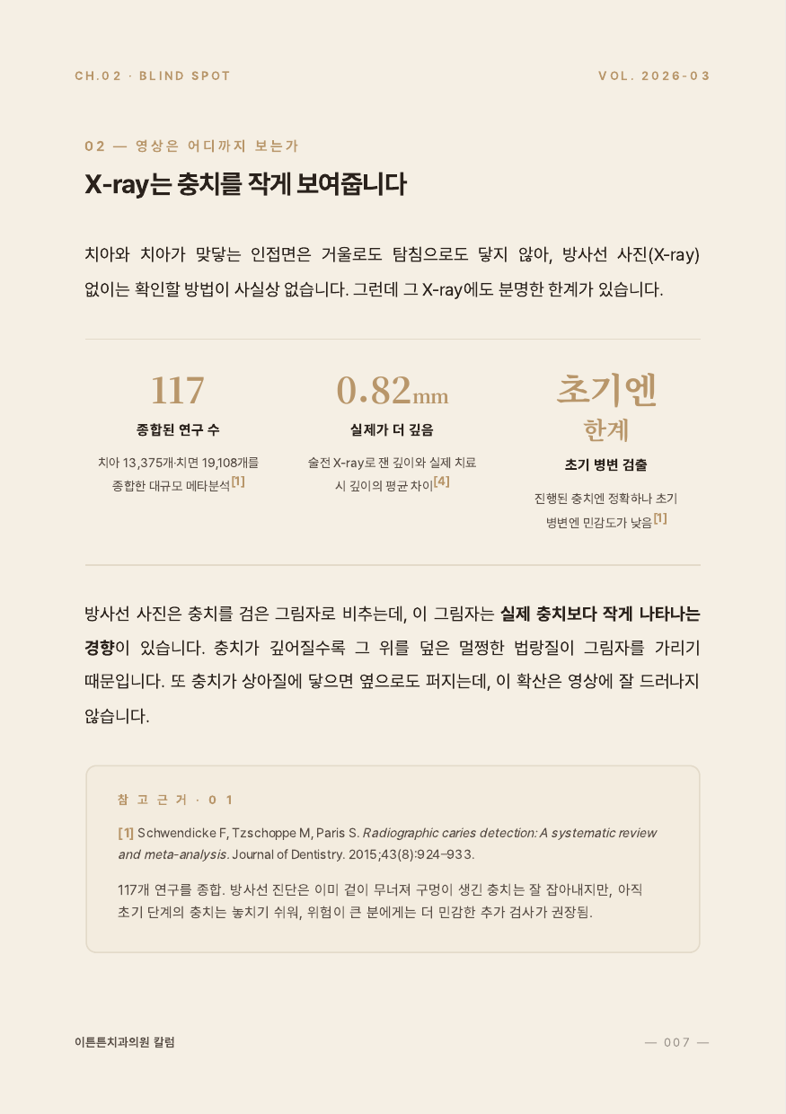 7면 X-ray는 충치를 작게 보여준다